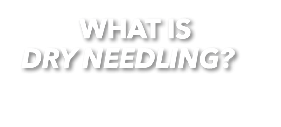 Bib_DryNeedling_Text What is Dry Needling